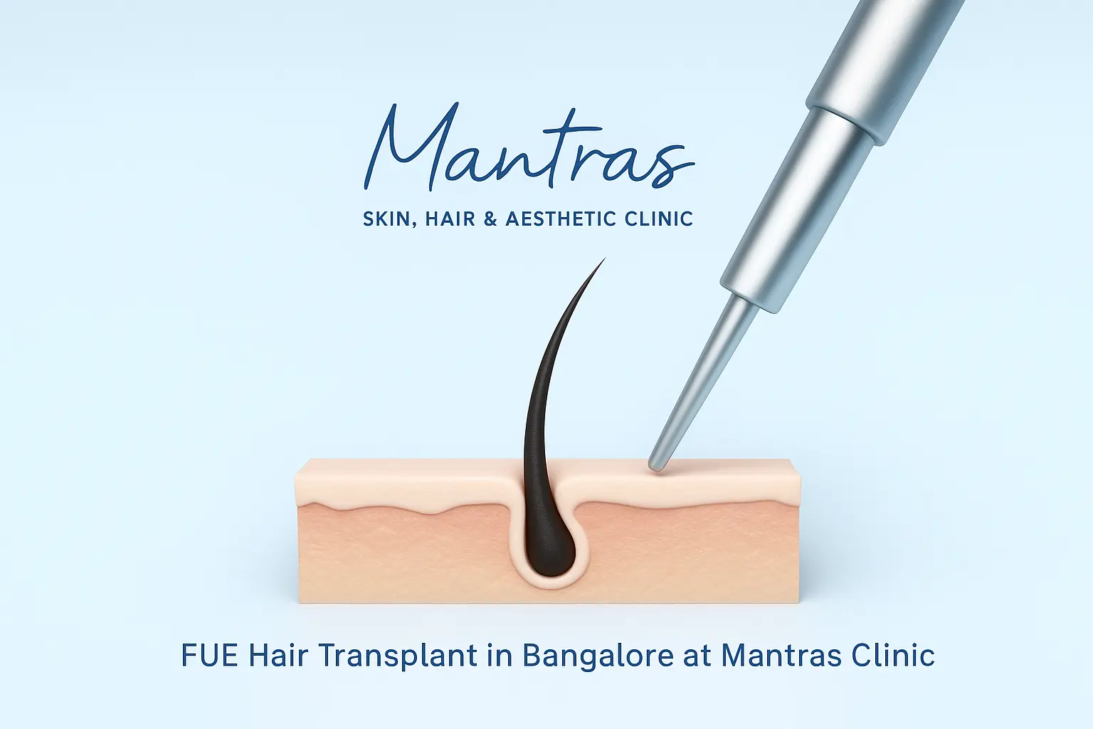 FUE Hair Transplant in Bangalore: Safe, Advanced & Effective Hair Restoration